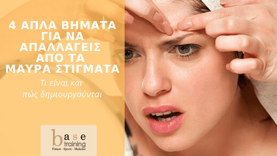 4 απλά βήματα για να απαλλαγείς από τα μαύρα στίγματα – Τι είναι και πώς δημιουργούνται